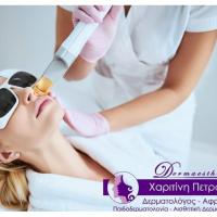 Fractional Laser ( ουλές ακμής, ρυτίδες, ραγάδες, πανάδες )