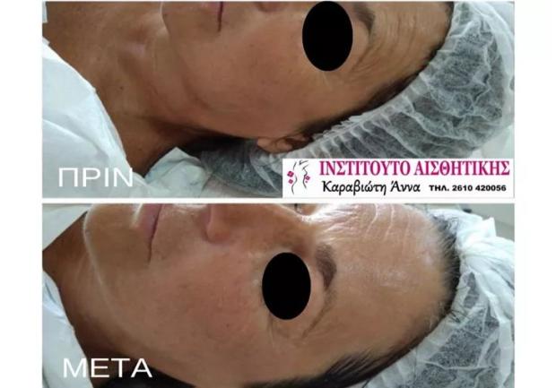 Καραβιώτη Άννα, Αισθητικός στην Πάτρα, Περιποίηση Προσώπου
