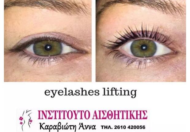 Καραβιώτη Άννα, Αισθητικός στην Πάτρα, Lifting Βλεφαρίδων