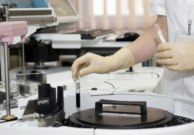 Ντεϊμεντέ Χριστίνα | Μικροβιολόγος στην Πάτρα, εργαστήριο